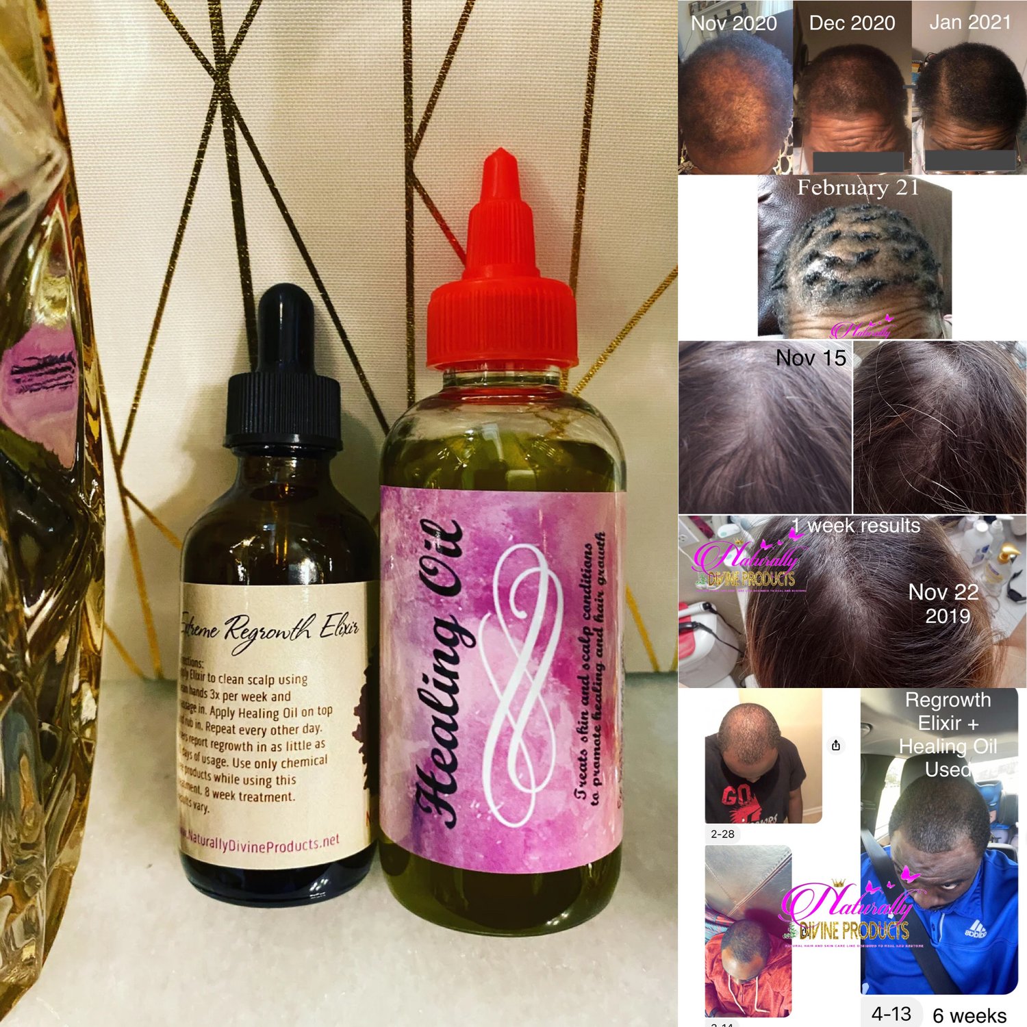 Category: Extreme Hair Regrowth Elixir Systems | Naturally Divine Products®  ~ The Brand That Heals®