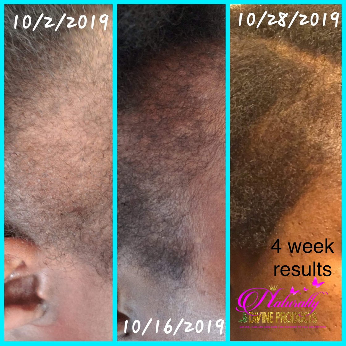 Image of Category: Extreme Hair Regrowth Elixir Systems