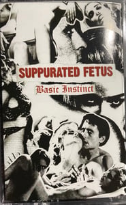 Image of Suppurated Fetus - Basic Instinct CS