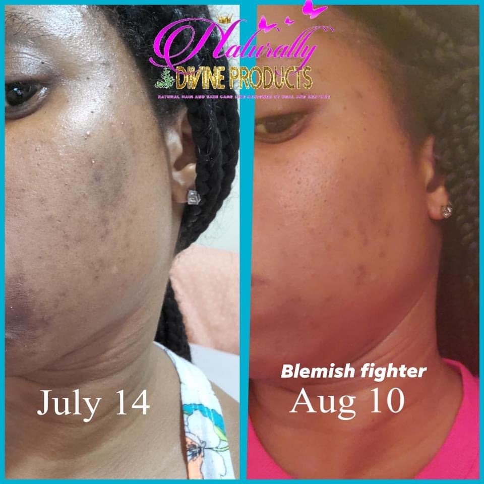 Image of Blemish Fighter