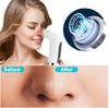 Hydra Facial & Blackhead Removal Device