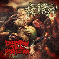 Apoplexy- dissection till perfection 