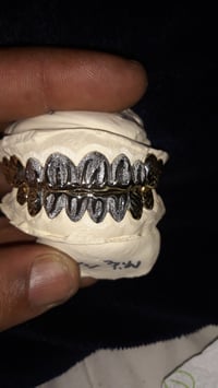 Image of GOLDYLOXGRILLZ 