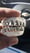 Image of GOLDYLOXGRILLZ 
