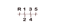 Image 2 of Heartbeat Of A Racer 5 speed