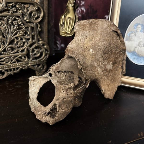 Image of Half Human Hip Bone