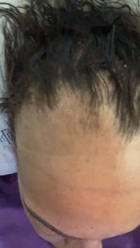 Image 4 of Mia’s hair growth oil 