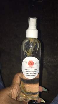 Acne Toner