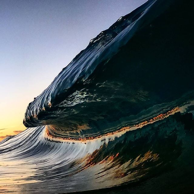 Image of morning sickness