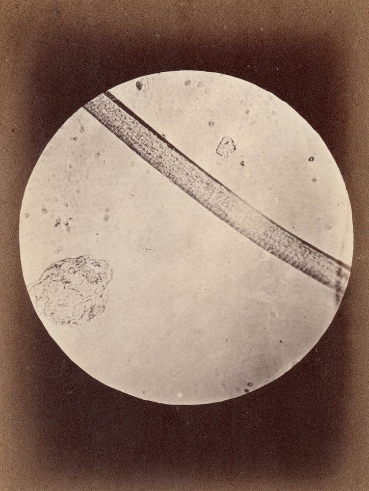 Image of  A. de Montméja: photomicrograph of Pelade, ca. 1868