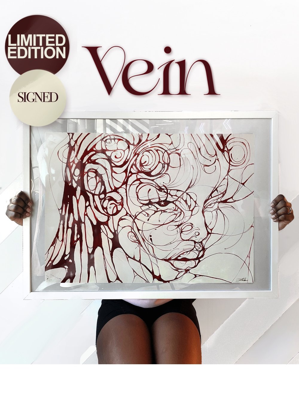 Vein