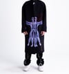 FRESH WOUNDS TRENCH
