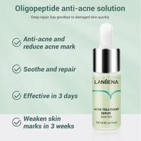 Acne Removal Serum