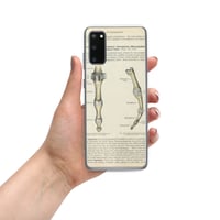 Image 11 of Antique Anatomical Drawing Bones Of The Finger Clear Case for Samsung®