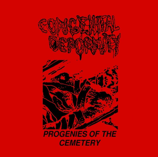 Image of CONGENITAL DEFORMITY - Progenies Of The Cemetery MCD