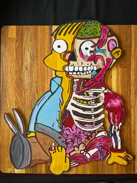 Ralph Wiggum Anatomy