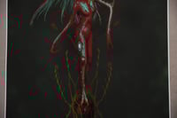 Image 5 of “Carcinogenesis” 