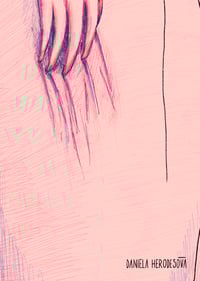 Image 5 of Itchy Back