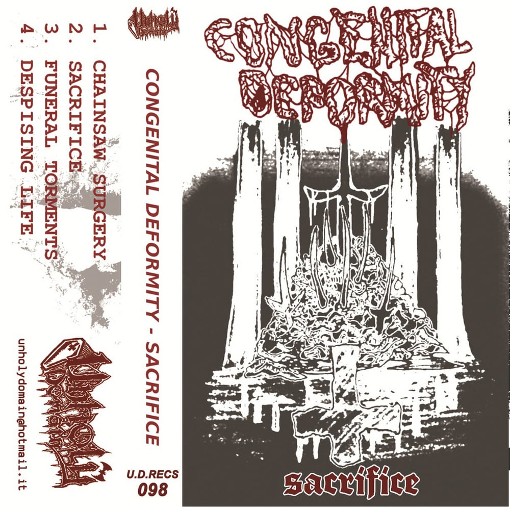 Image of Congenital Deformity - Sacrifice Cassette
