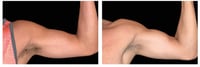 Image 1 of BODY SCULPTING 