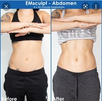 Image 2 of BODY SCULPTING 