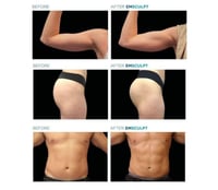 Image 3 of BODY SCULPTING 