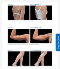 Image 4 of BODY SCULPTING 