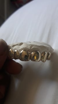 Image of GOLDYLOXGRILLZ 