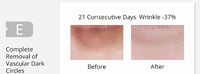 Image 3 of FACE LIFT 45 MINUTES to 1hr treatment session