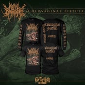 Image of Officially Licensed Agonal Breathing "Colovaginal Fistula" Short/Long Sleeve Shirts!!
