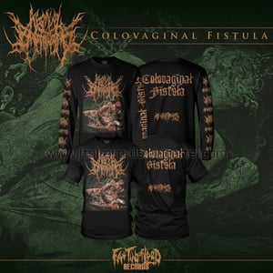 Image of Officially Licensed Agonal Breathing "Colovaginal Fistula" Short/Long Sleeve Shirts!!