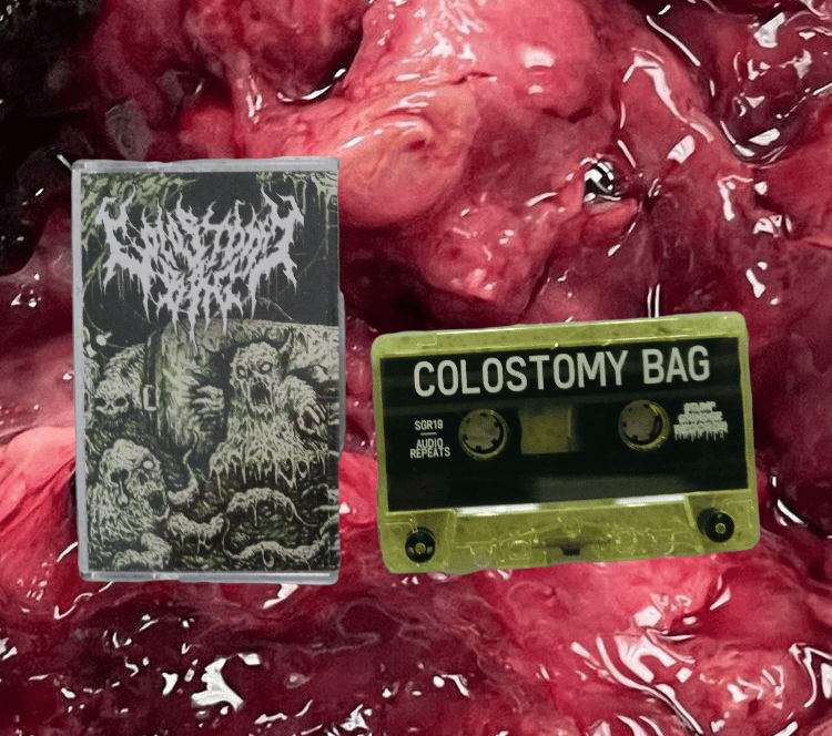 Image of Colostomy Bag 