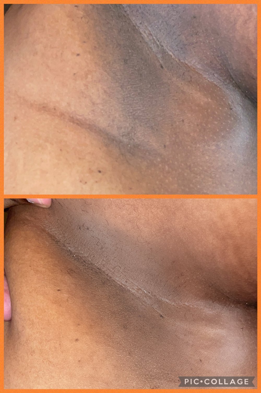 Image of Turmeric & Vitamin C Full Body Scrub