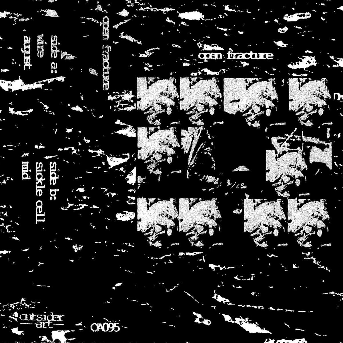 Open Fracture Open Fracture Outsider Art