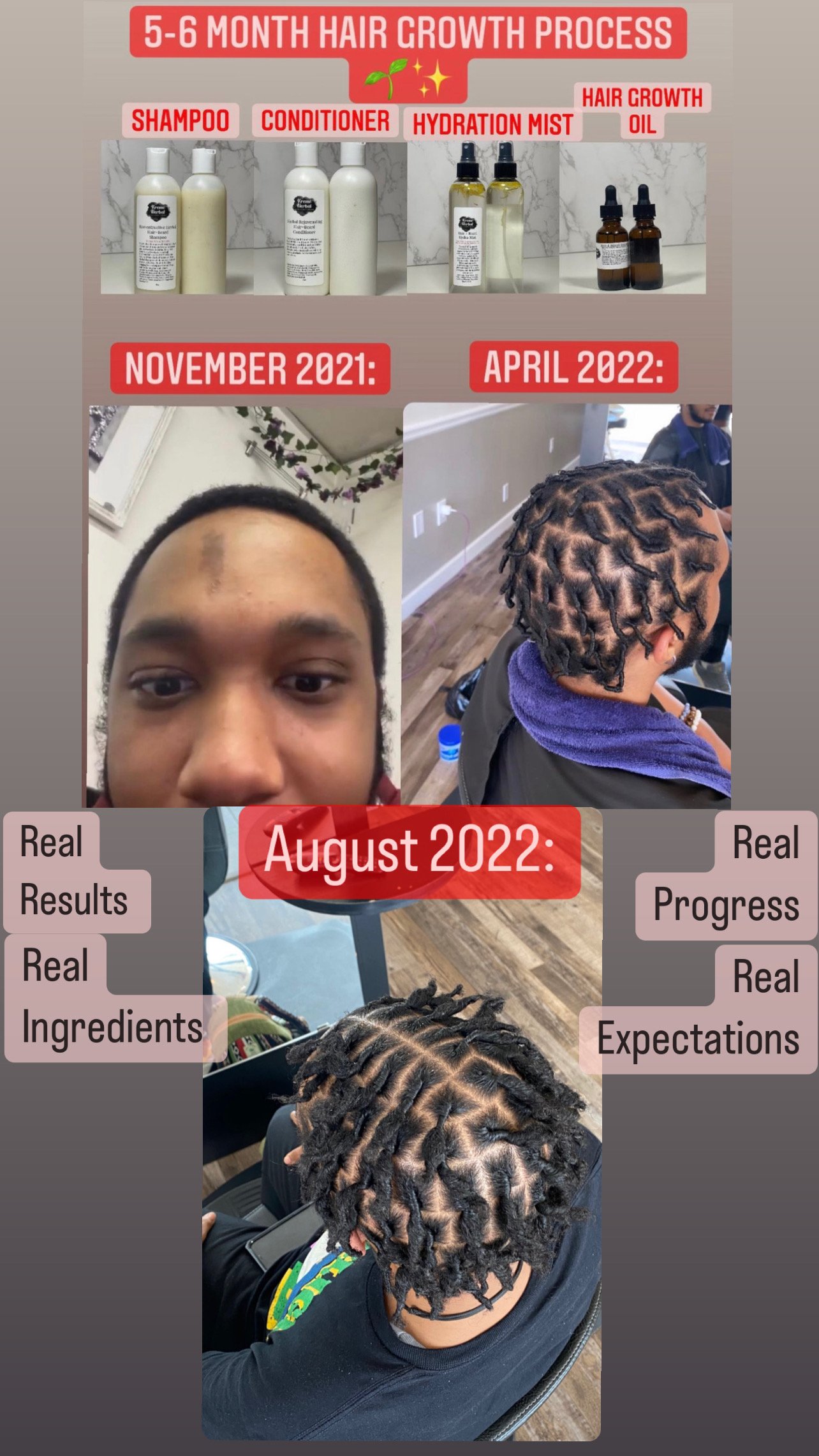Image of Ultimate Hair Care Package🌱