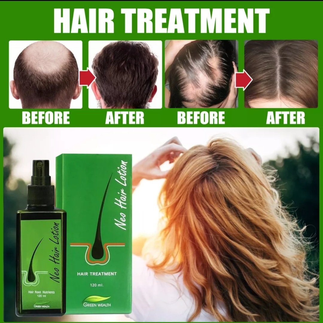 Hair Growth lotion Oasisappear