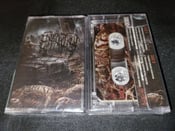 Image of TAPES – EPICARDIECTOMY – RELICS FROM MALODOROUS PILE