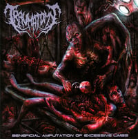 Traumatomy-beneficial amputation of excessive limbs cd