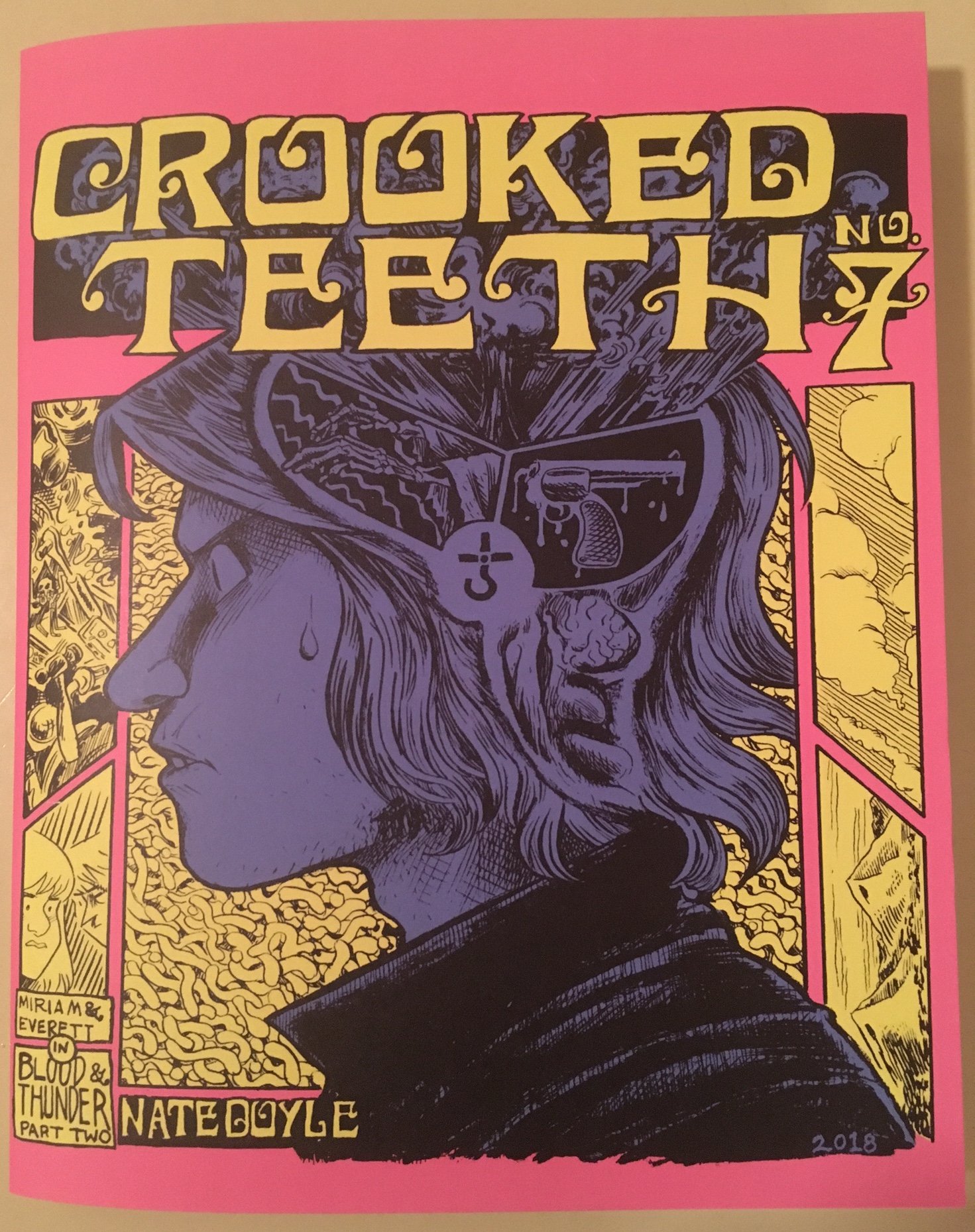 Image of Crooked Teeth #7 