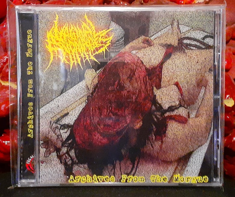 Image of VAGINAL ANOMALIES - Archives from the Morgue CD