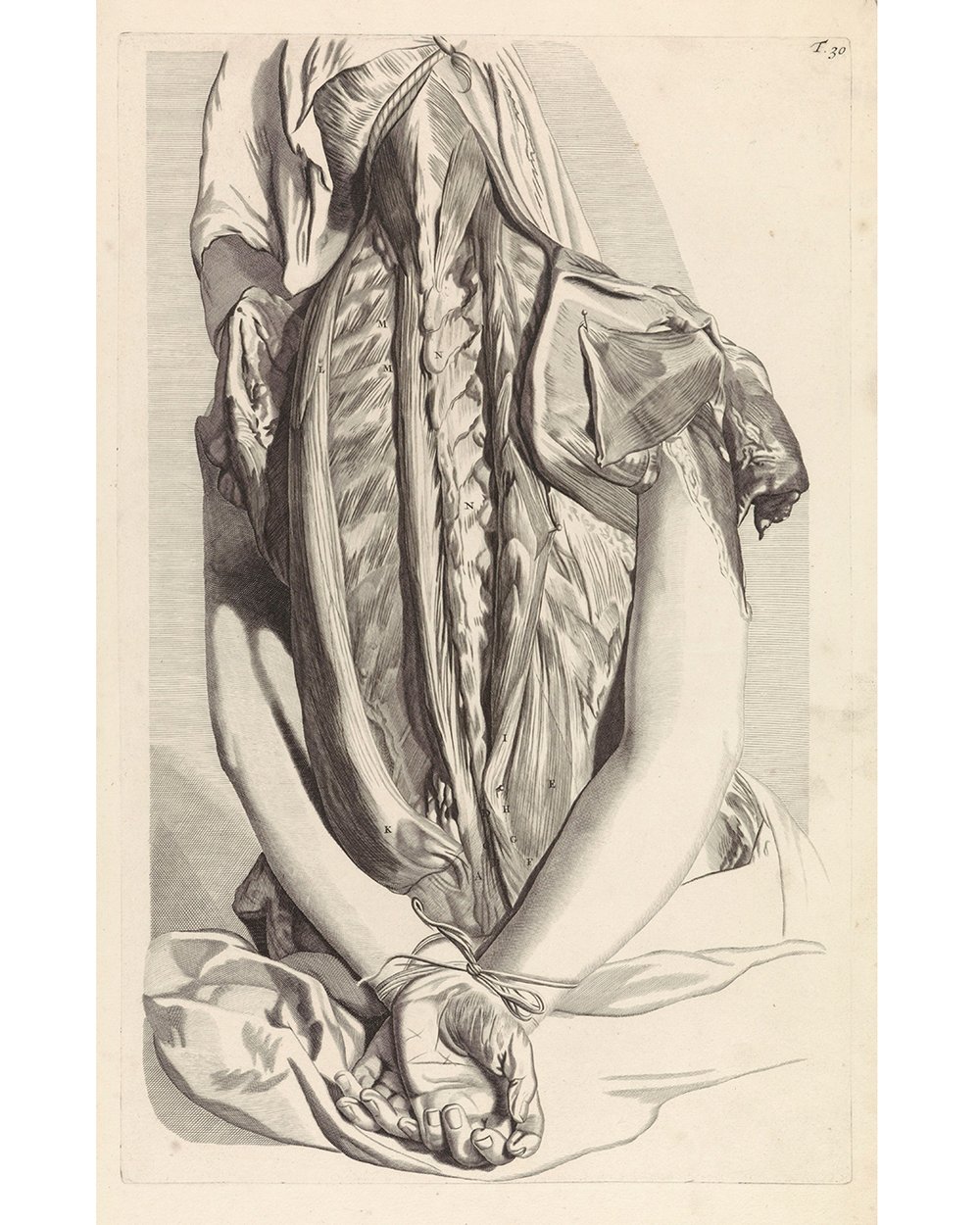 "Anatomical study of the back and upper arms of a tied up woman" (1685)