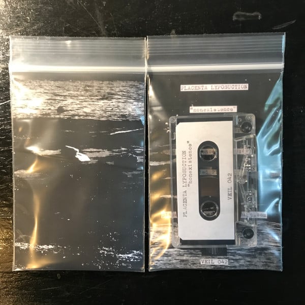 Image of VEIL 042: Placenta Lyposuction "nonexistence" cs