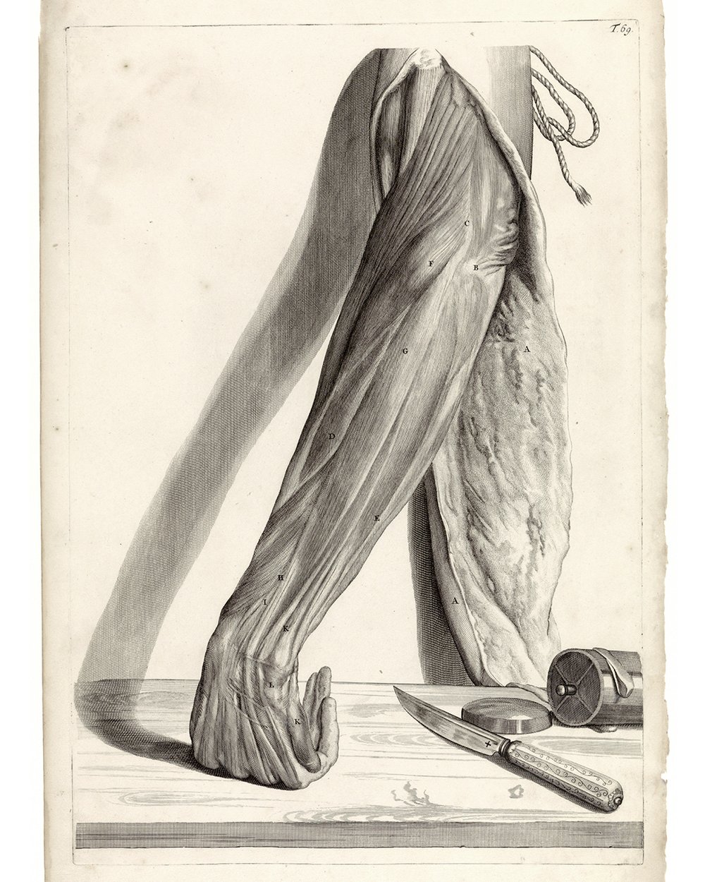 ''Anatomical study of a skinned left forearm'' (1685)