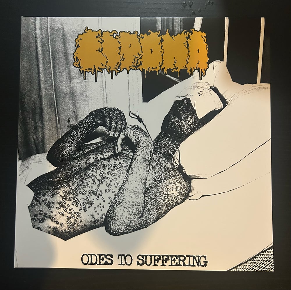 Lipoma: Odes to Suffering- SUPER LIMITED SWIRL