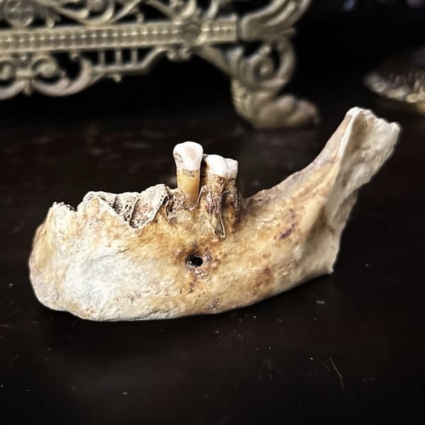 Image of Human Mandible Partial 2 Teeth