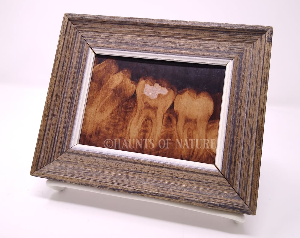 Wood Burned Dental Xray