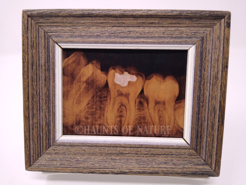 Wood Burned Dental Xray