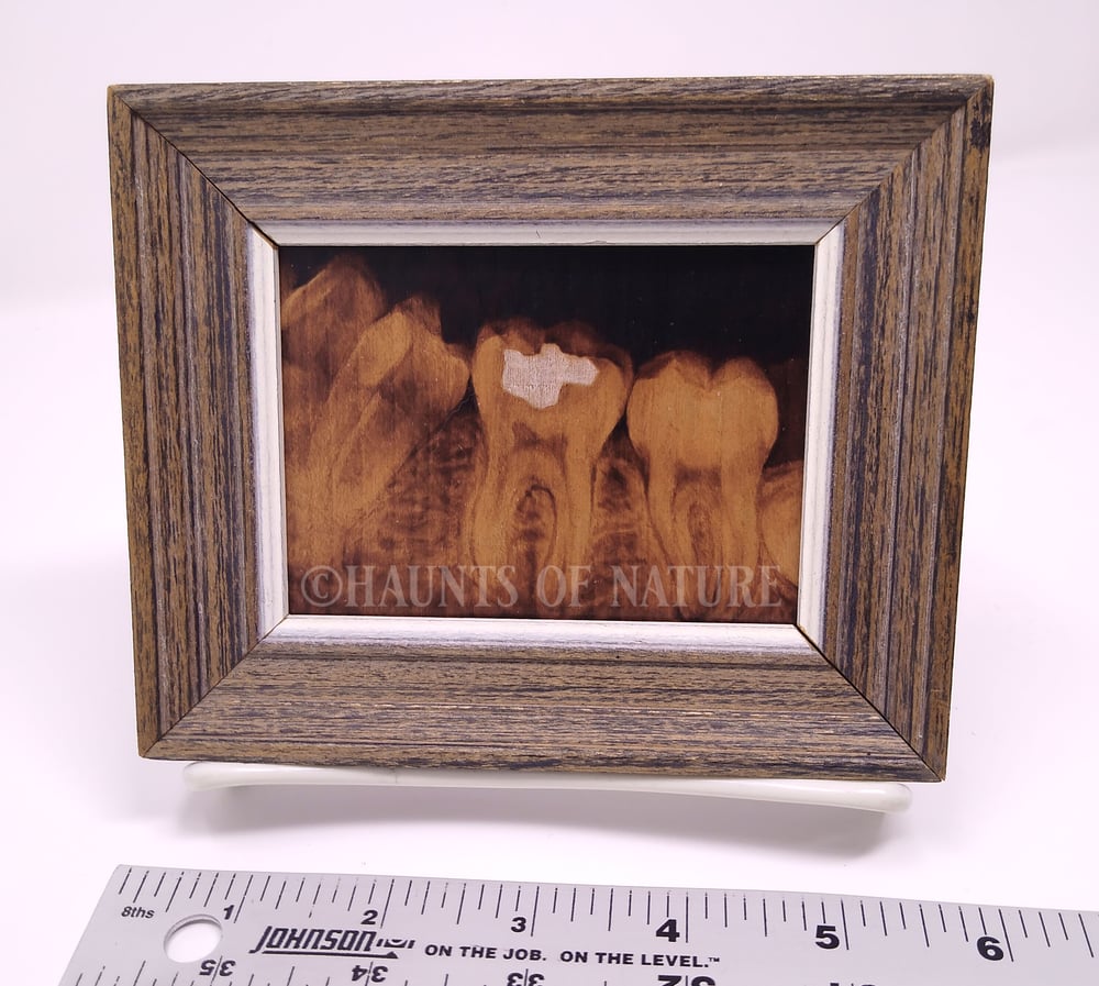 Wood Burned Dental Xray