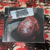 MALIGNANT HYPERTHERMIA - "CUTANEOUS BLASTOMYCOSIS" CD