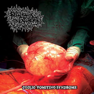 Image of FOETAL FLUIDS TO EXPURGATE Cyclic Vomiting Syndrome CD/TAPE - Pre-Order !